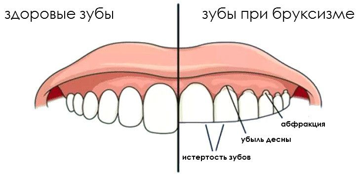 478022456_w640_h640_bruksizm.png
