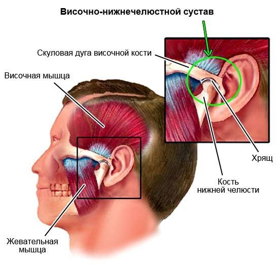 artrozvisochnonizhnechelyustnogosustavav_CB79D4A3.jpg