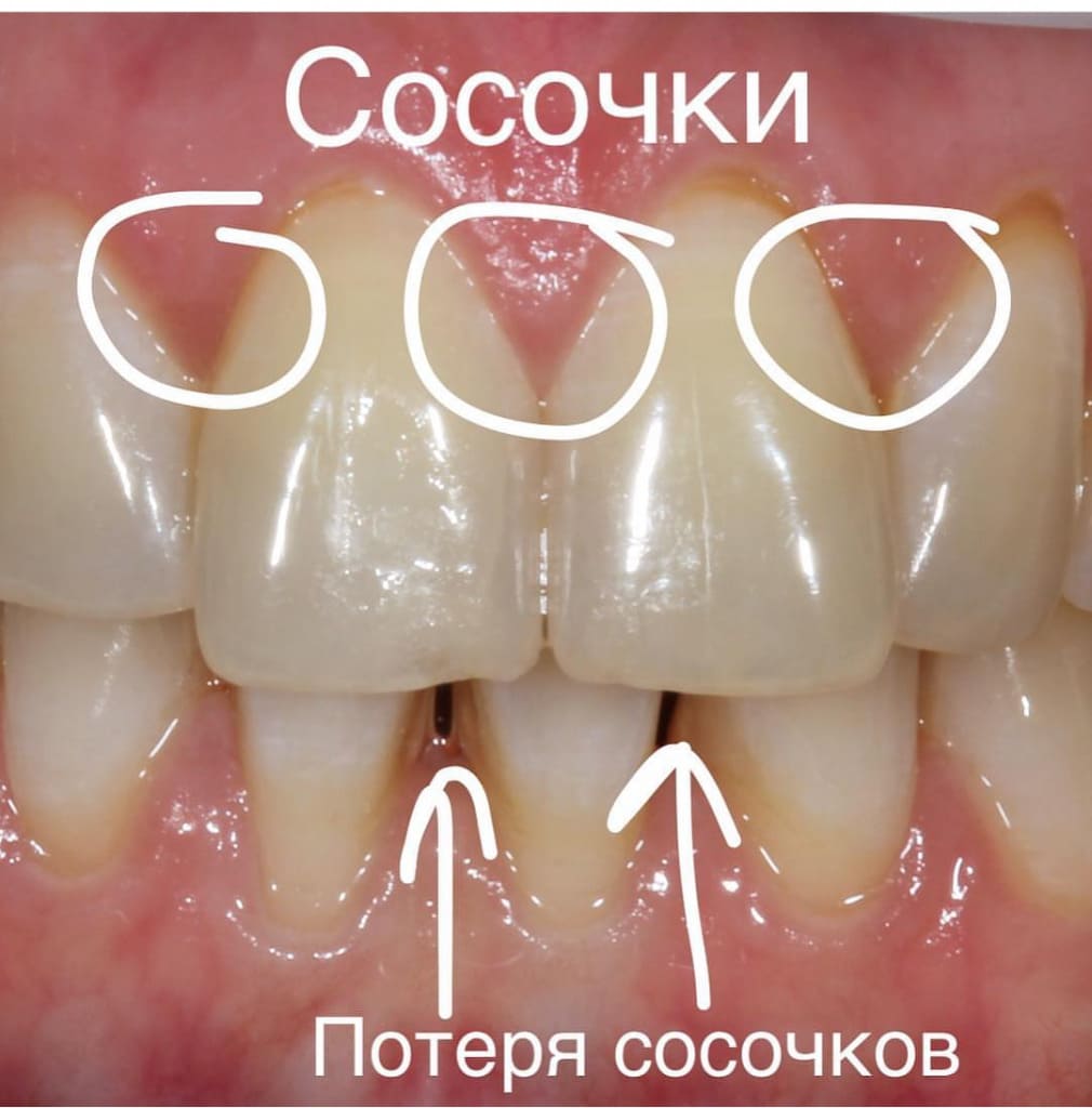 Зубы